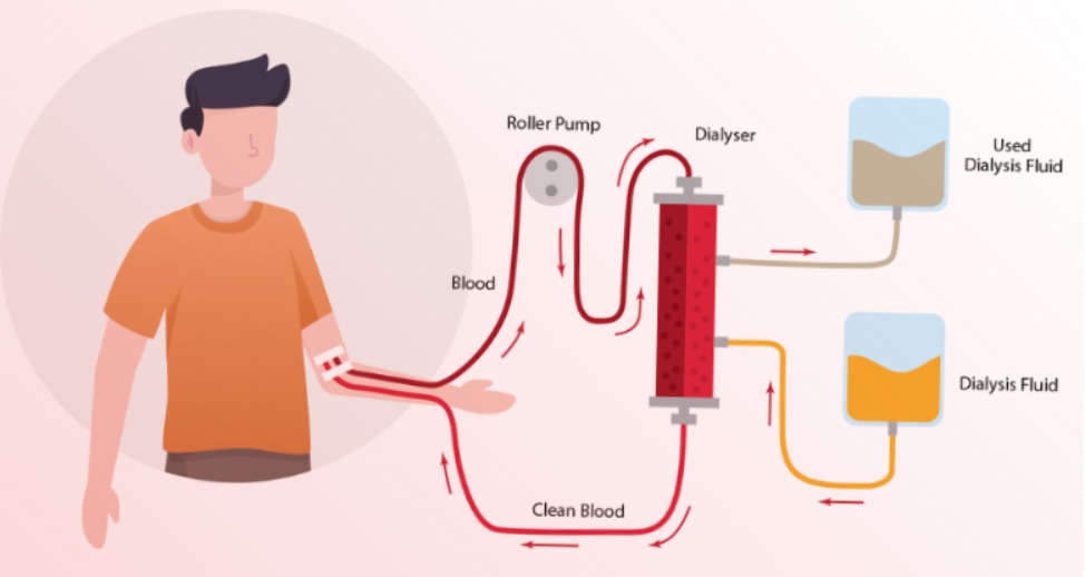 Child-friendly dialysis room with caring medical staff